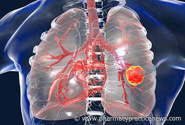Osimertinib Plus Chemo Prolongs PFS in EGFR/TP53-Mutated NSCLC