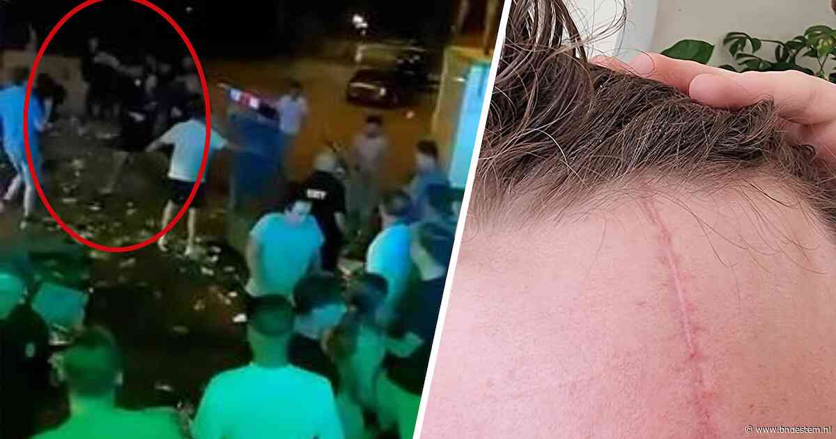Siem (19) stond rustig een biertje te drinken, tot een autokrik zijn voorhoofd raakte: ‘Vanaf toen weet ik niets meer’