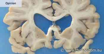 The data on contact sport, concussion and CTE is convincing. But not conclusive