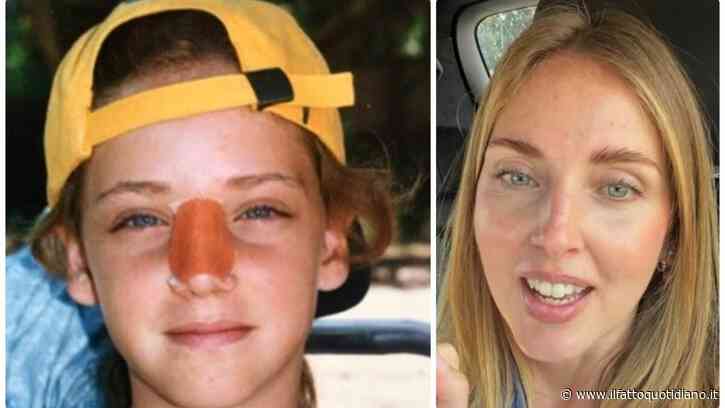 “Mi sono data una ginocchiata facendo bodysurf e il mio naso era tutto storto. Mio papà me lo ha subito girato, ma me lo sono dovuto operare lì alle Hawaii”: Chiara Ferragni racconta l’incidente avuto a 10 anni