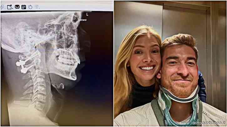 “Ho rischiato di non camminare più, non riuscivo a muovere il collo. Ora ho quattro viti”: così Klinsmann jr