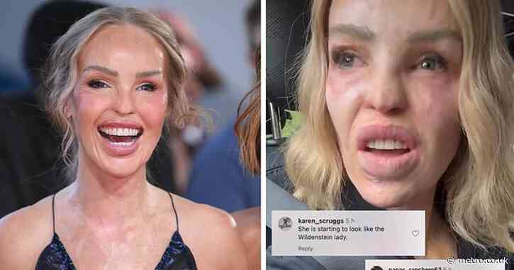 Katie Piper emotional revealing vile abuse after National Television Awards red carpet
