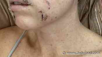 Arizona mother mauled by coyote while bravely fighting animal off four-year-old daughter