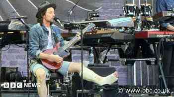 James Bay performs with broken ankle at Bon Jovi gig