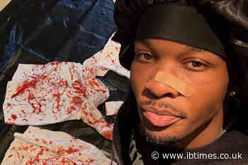 Civil Lawsuit Against Singer D4vd Alleges Wrongful Death, Sexual Battery and Human Trafficking