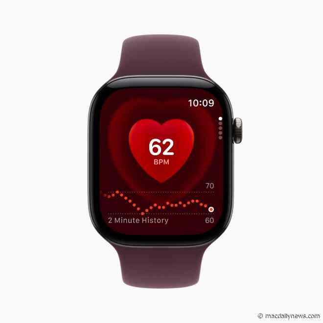 Apple Watch has the most accurate heart-rate sensor of any wearable