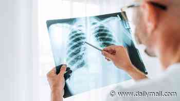 Terrifying map reveals America's lung cancer explosion: State-by-state investigation uncovers alarming trend... but $20 test tells you find out if you are at risk
