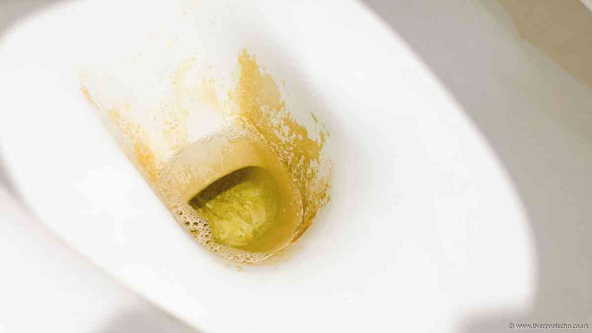 Ditch vinegar when cleaning toilet limescale for 'better' natural ingredient