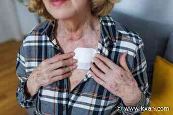 Estrogen patch shortage leaves patients frustrated
