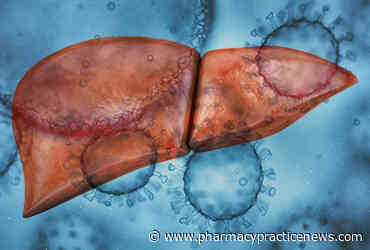 People Living With HIV Have Comparable Long-Term Outcomes After Modern Liver Transplantation