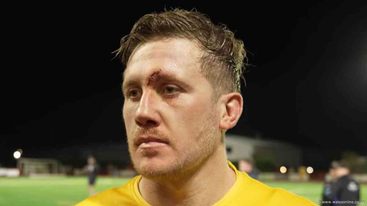 Wales international scarred in training accident and Springboks statement issued