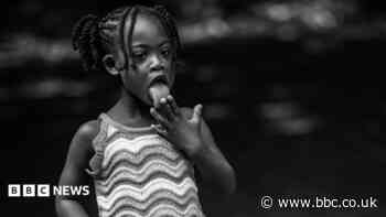 Down's syndrome project promotes black visibility