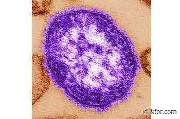 Pennsylvania woman dies from measles complications amid growing outbreak