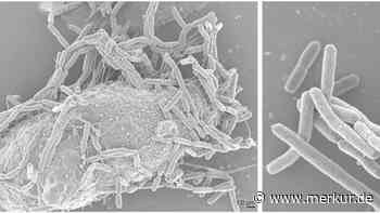Gefährliche E.-coli-Bakterien haben einen Trick, um sich weiter auszubreiten