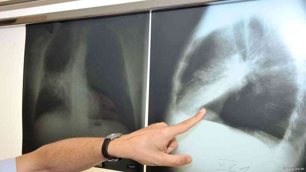 Wissenschaftler lösen jahrzehntealtes DNA-Rätsel – mit möglichen Folgen für die Krebsforschung