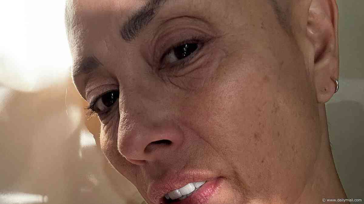 Melanie Sykes shares photos of her shaven head in glowing selfies after revealing she lost 'two thirds' of her hair due to alopecia