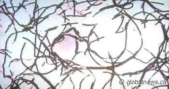 Anthrax outbreak kills more than 50 animals, infects 12 people in Zambia