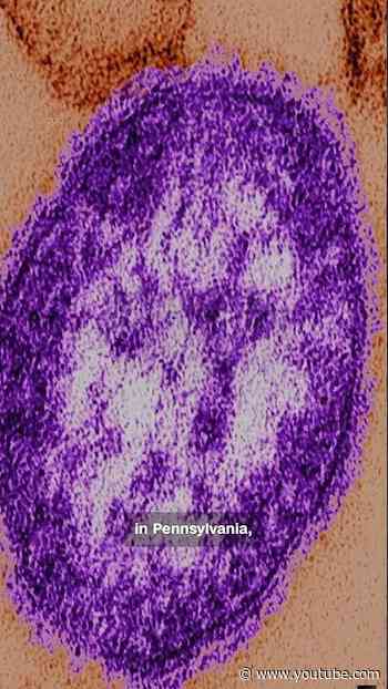 Unvaccinated woman is third measles-related death in Pennsylvania