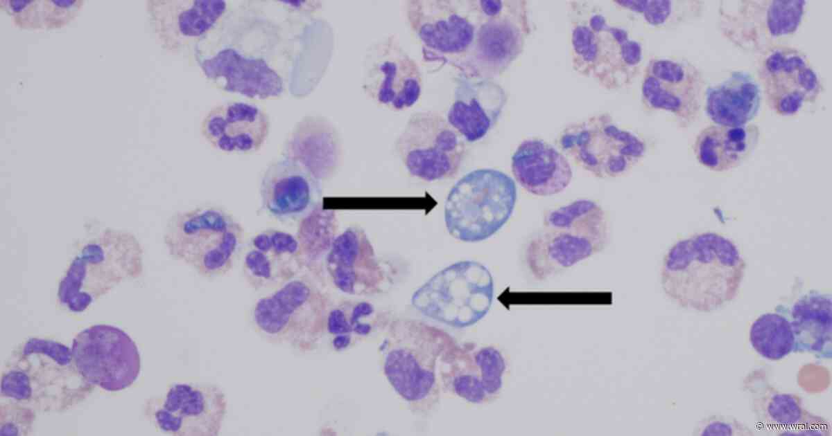 Investigation: Durham water feature likely source of teen’s deadly ‘brain-eating’ amoeba infection