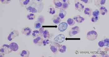 Investigation: Durham water feature likely source of teen’s deadly ‘brain-eating’ amoeba infection