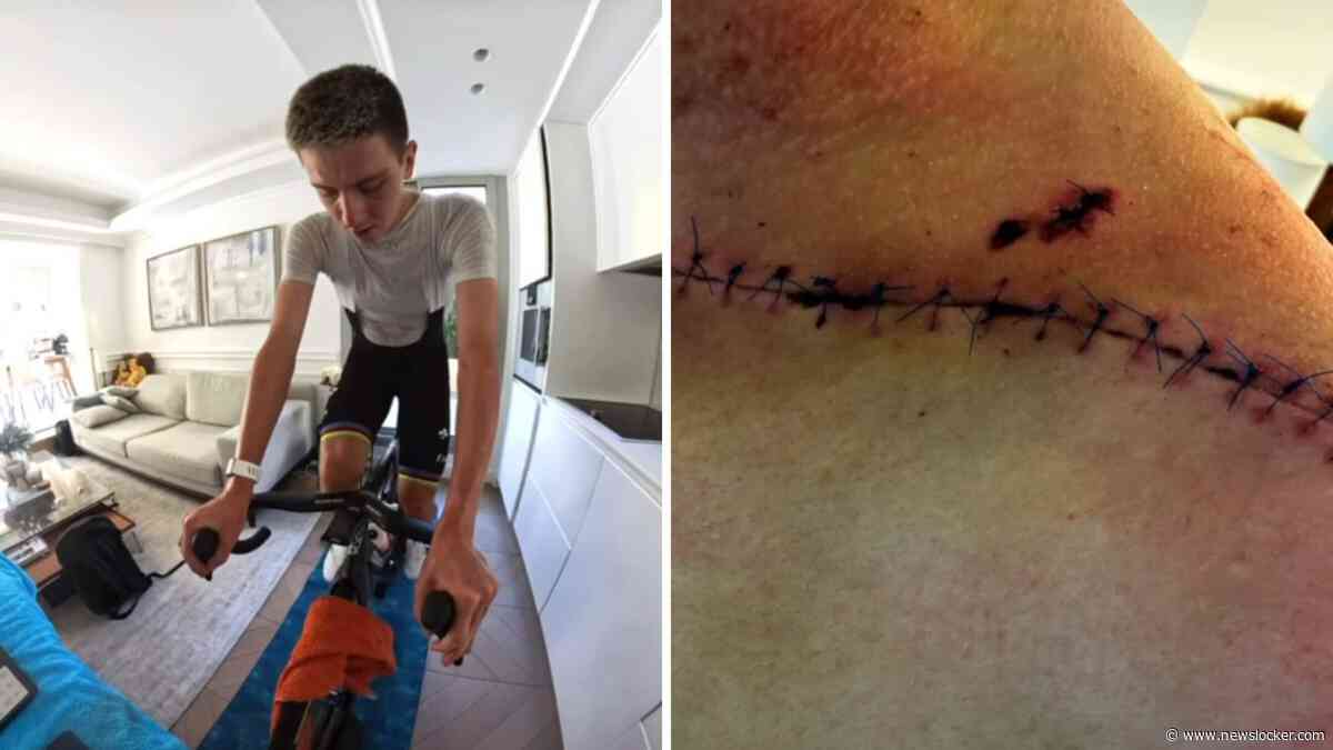Tadej Pogacar geeft inkijkje in revalidatie en toont pijnlijke littekens: ’Zo had ik mij september niet ingebeeld’