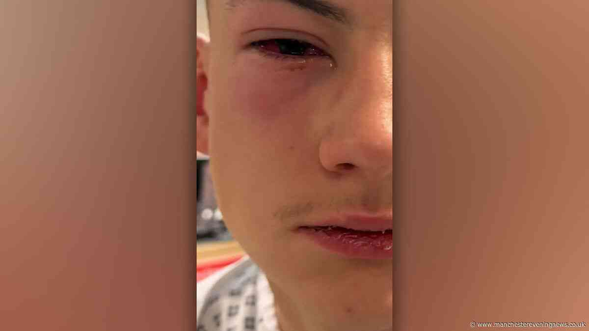 Teenage football fan injured in city centre substance attack 'thought his eyes were on fire'
