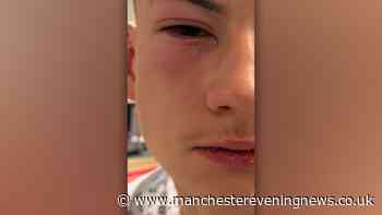 Teenage football fan injured in city centre substance attack 'thought his eyes were on fire'