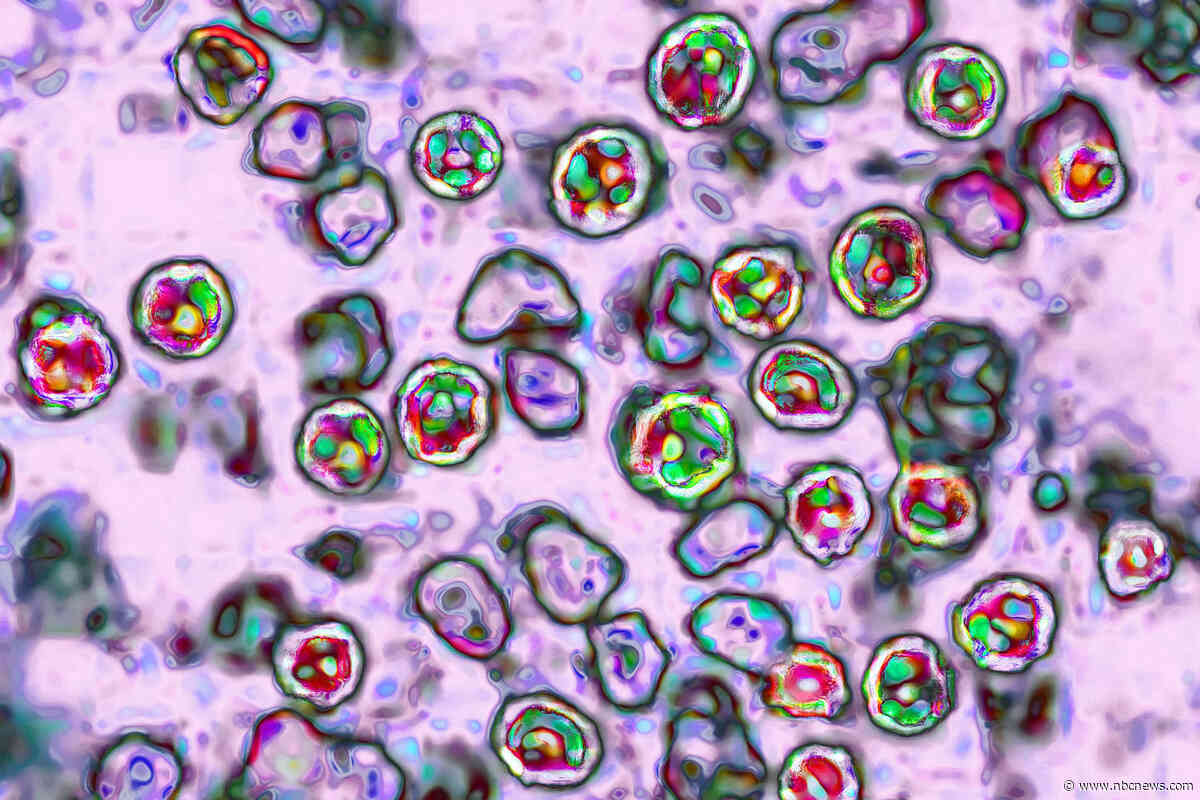 Pennsylvania teen dies from measles complications, health officials report