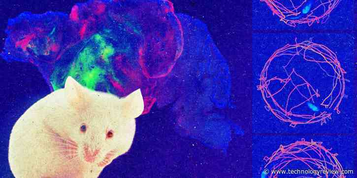 Meet a mouse whose brain cortex is made up of human cells