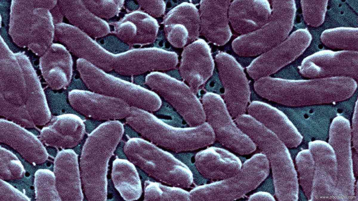 4th Florida death linked to ‘flesh-eating' bacteria this year is person in Broward