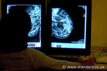 Breast cancer: Women in their 30s and 40s ‘should be warned of alcohol risk’