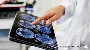 New MS treatment 'within reach' after existing drug discovery