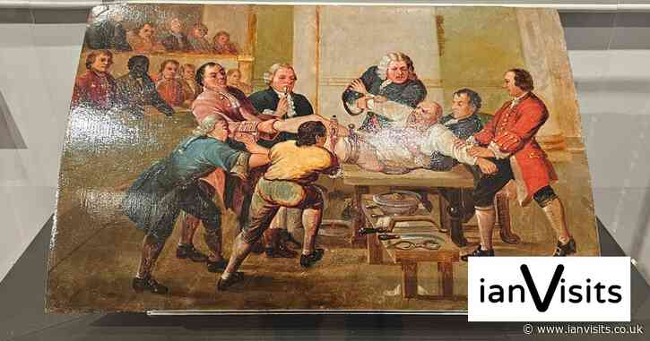 Exhibition shows off when hospital surgery really was a theatre