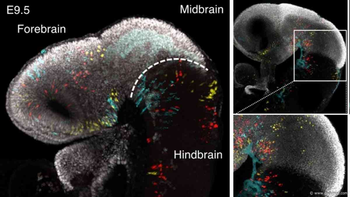 Now that's what you call mind-blowing! The human brain is TWO separate organs, scientists reveal