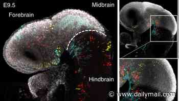 Now that's what you call mind-blowing! The human brain is TWO separate organs, scientists reveal