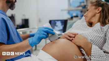 NHS chiefs aim to rebuild trust in maternity care