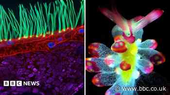 See tiny organisms on show in microscopic video competition
