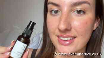 Bride who 'cleared spots' for wedding with 77p-a-day serum says 'skin is amazing'