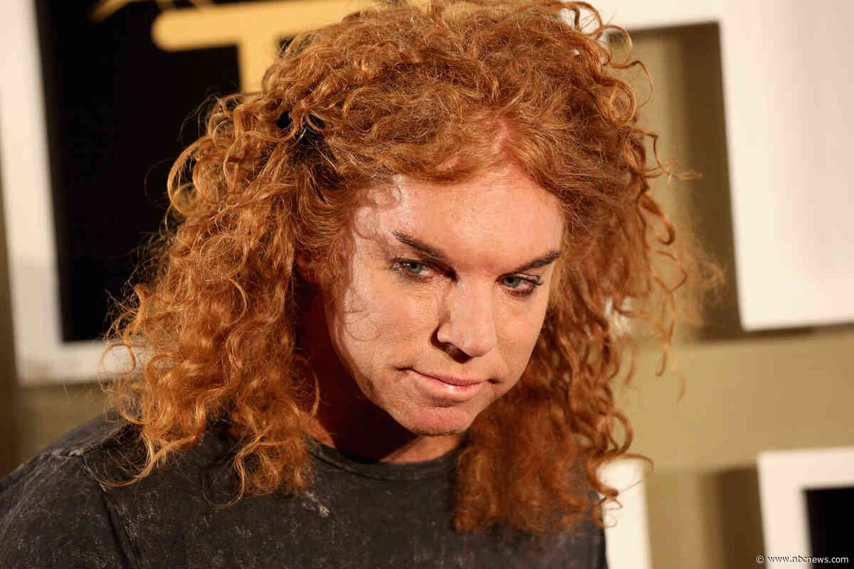 Comedian Carrot Top hospitalized and recovering, representative says