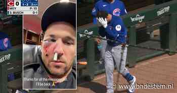Honkballer Chicago Cubs krijgt foutslag ploeggenoot van ruim 150 km/uur in zijn gezicht