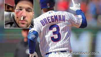 Honkballer Alex Bregman letterlijk ziekenhuis ingeslagen na foutslag van 154 kilometer per uur