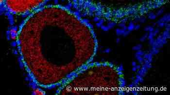 Wenn der Körper die eigene DNA bekämpft: Forscher stoßen auf Ursache vorzeitiger Alterung