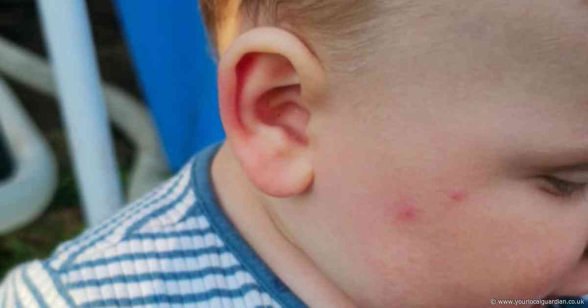 Carshalton mum left ‘batting bugs off baby son’ after nightmare infestation