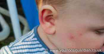 Carshalton mum left ‘batting bugs off baby son’ after nightmare infestation