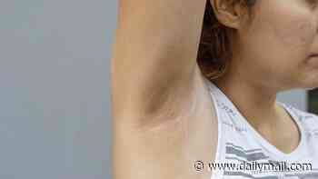 Mysterious brown marks have appeared under my armpits and breasts. I'm an otherwise healthy woman but I'm worried. DR SCURR reveals how to tell a common bacterial infection from something MUCH more sinister