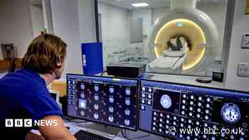 Brain health clinic aims to 'transform' dementia care
