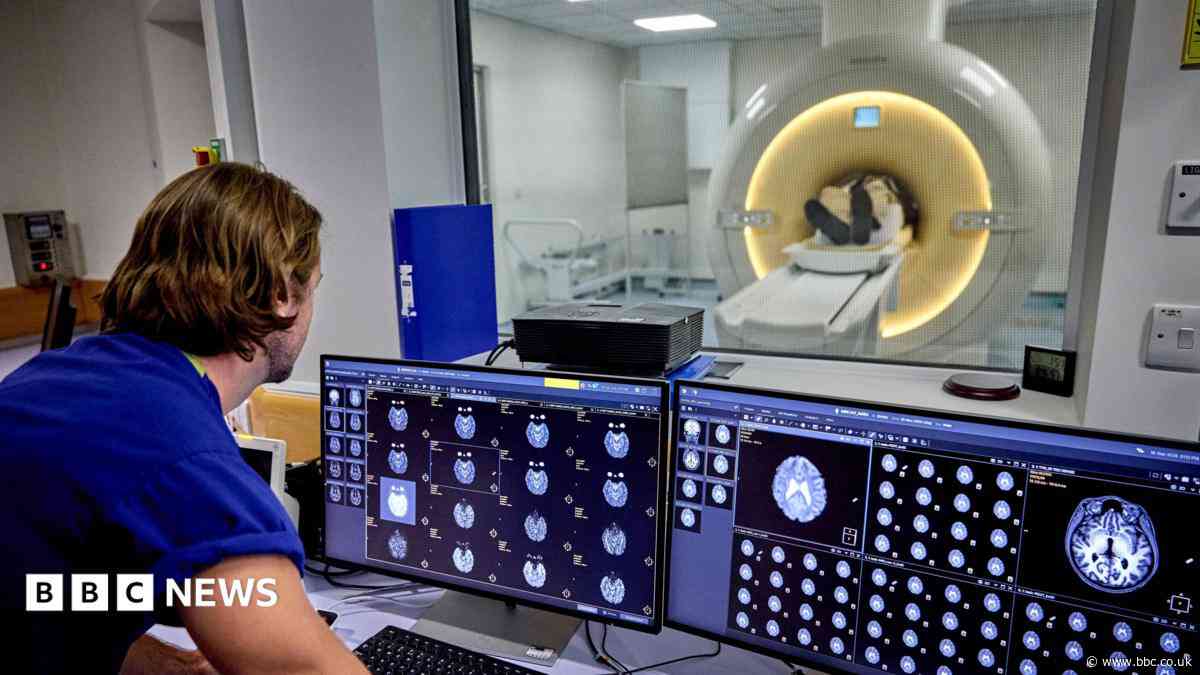 Brain health clinic aims to 'transform' dementia care