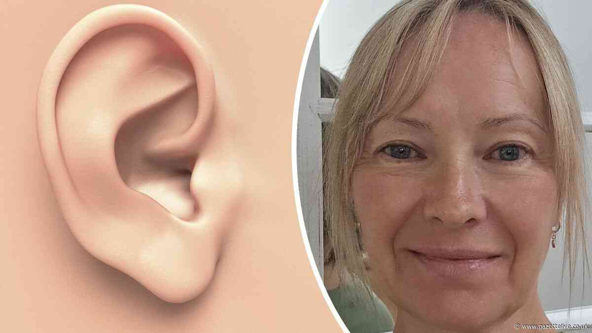 Meet 'The Ear Queen': Marton mum and former nurse launches wax removal service