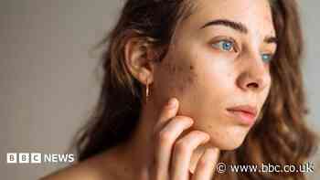 The simple skincare routine for teens that actually works - and five expert tips