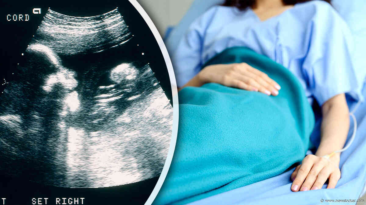 SGP waarschuwt na proef met late abortussen: ’Kans dat wij ons constructief opstellen wordt kleiner’